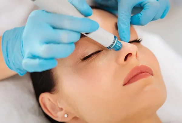 Hydrafacial in Attapur, Tolichowki : Cost, Results | MCAO Clinics Hyderabad
